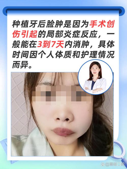 种牙后几天能消肿？术后肿胀一般多久消退？-图2