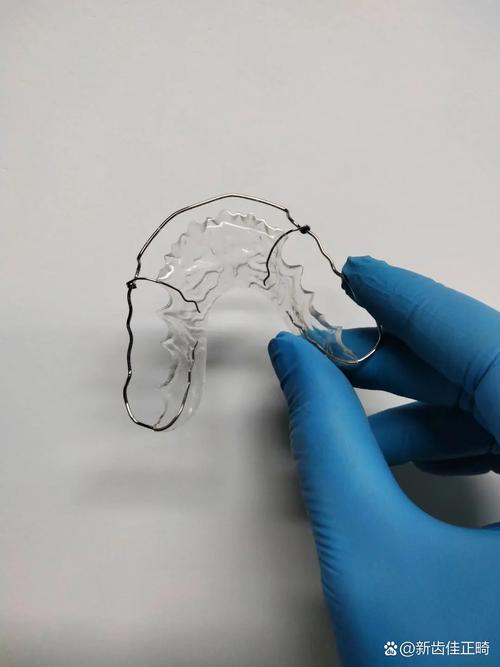 牙外伤固定方法如何选择？具体适用情况有哪些？-图3