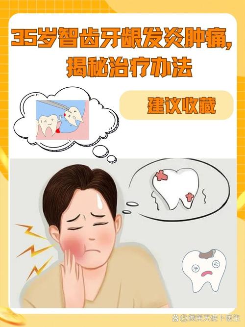 智齿治疗有哪些方法？如何选择最佳方案？-图3