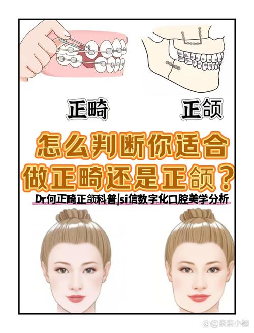 正畸一科和二科的区别-图3