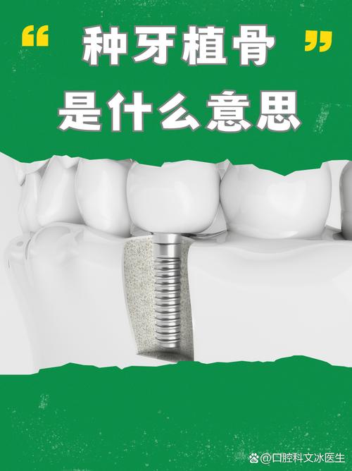 植骨手术后一般需要多久才能种牙？-图2