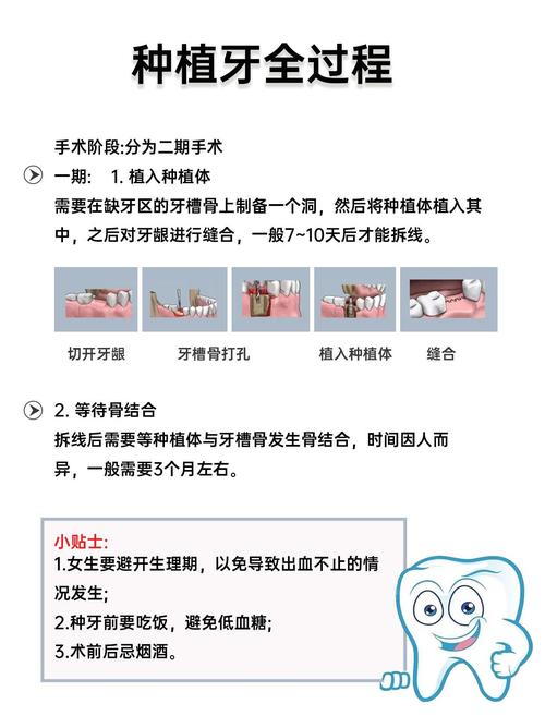 种牙成功率究竟有多高？哪些因素决定种植成败？-图3