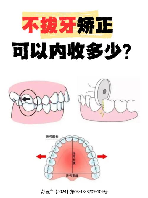 压低大牙的方法有哪些？效果和注意事项如何？-图1