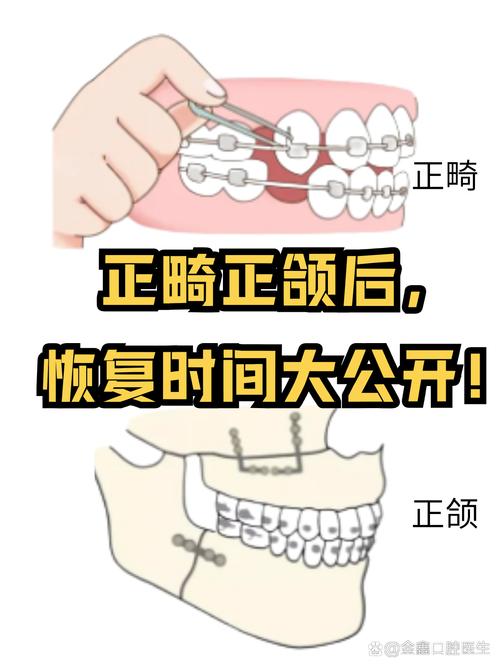 压低大牙的方法有哪些？效果和注意事项如何？-图3