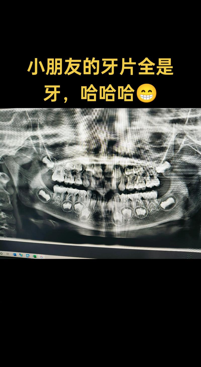 小牙片拍摄的正确方法是什么？关键步骤有哪些？-图1