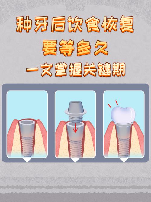 种牙后一般需要多长时间才能正常吃东西？-图2