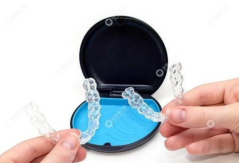 交大口腔医院正畸贵吗-图2