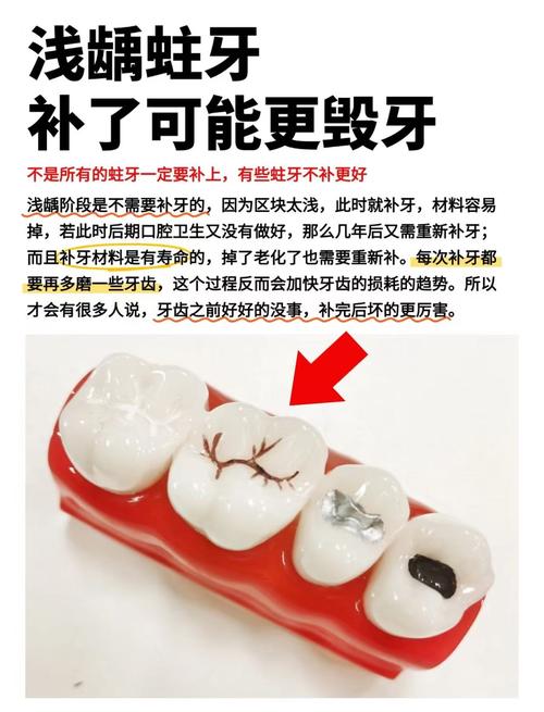 有十颗龋齿能做正畸吗-图2