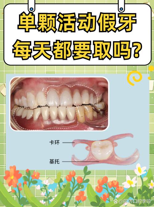 长沙镶牙的方法有哪些？各自特点是什么？-图3