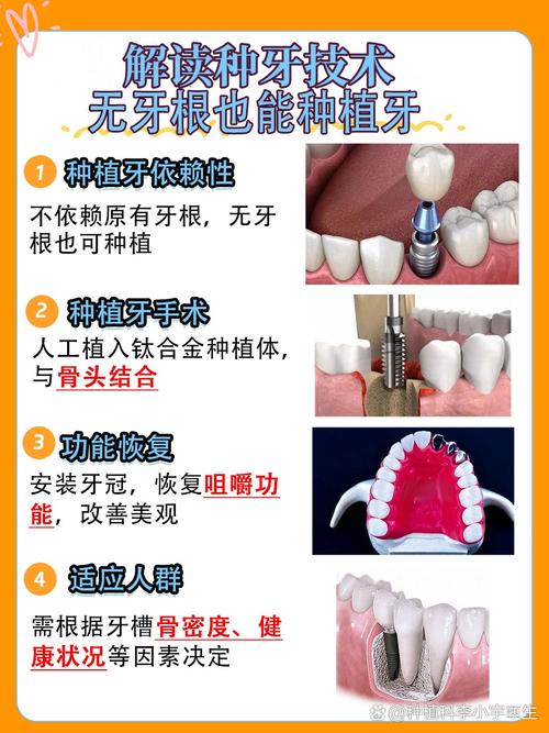 没有牙根能种牙吗？种植体如何实现稳固？-图1