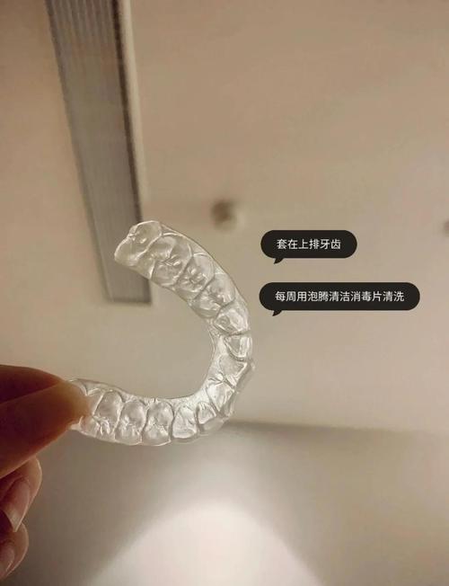 如何制作牙合垫？具体步骤与注意事项有哪些？-图1