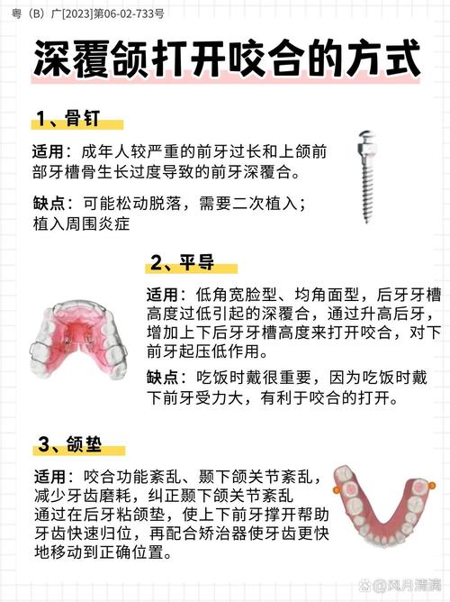 如何制作牙合垫？具体步骤与注意事项有哪些？-图2