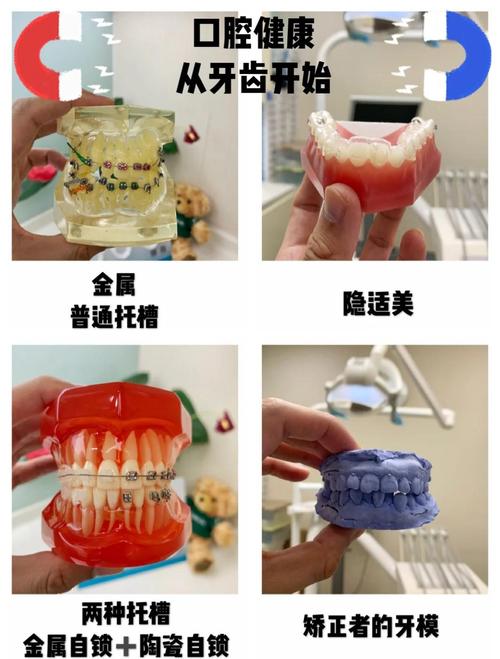 正畸托槽不见了，该怎么处理？-图2