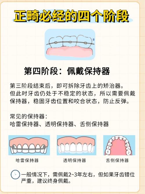 正畸分牙有哪些常用方法？如何选择合适的方式？-图1