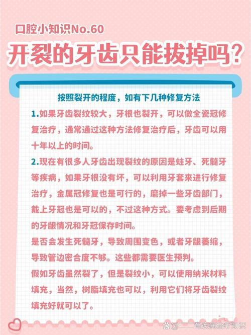 牙裂了该怎么治疗？不同裂度的治疗方法有哪些？-图2
