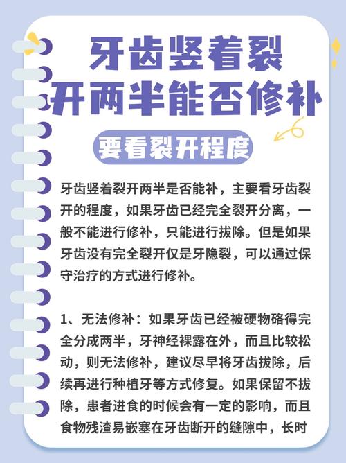 牙裂了该怎么治疗？不同裂度的治疗方法有哪些？-图3