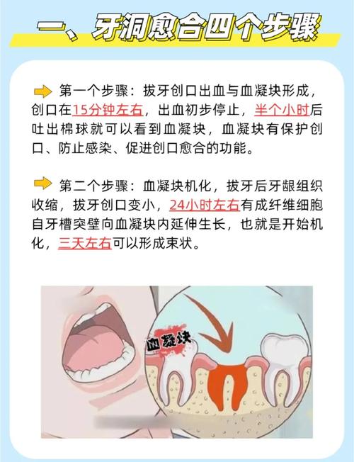 如何掌握简单有效且安全的拔牙操作方法？-图1