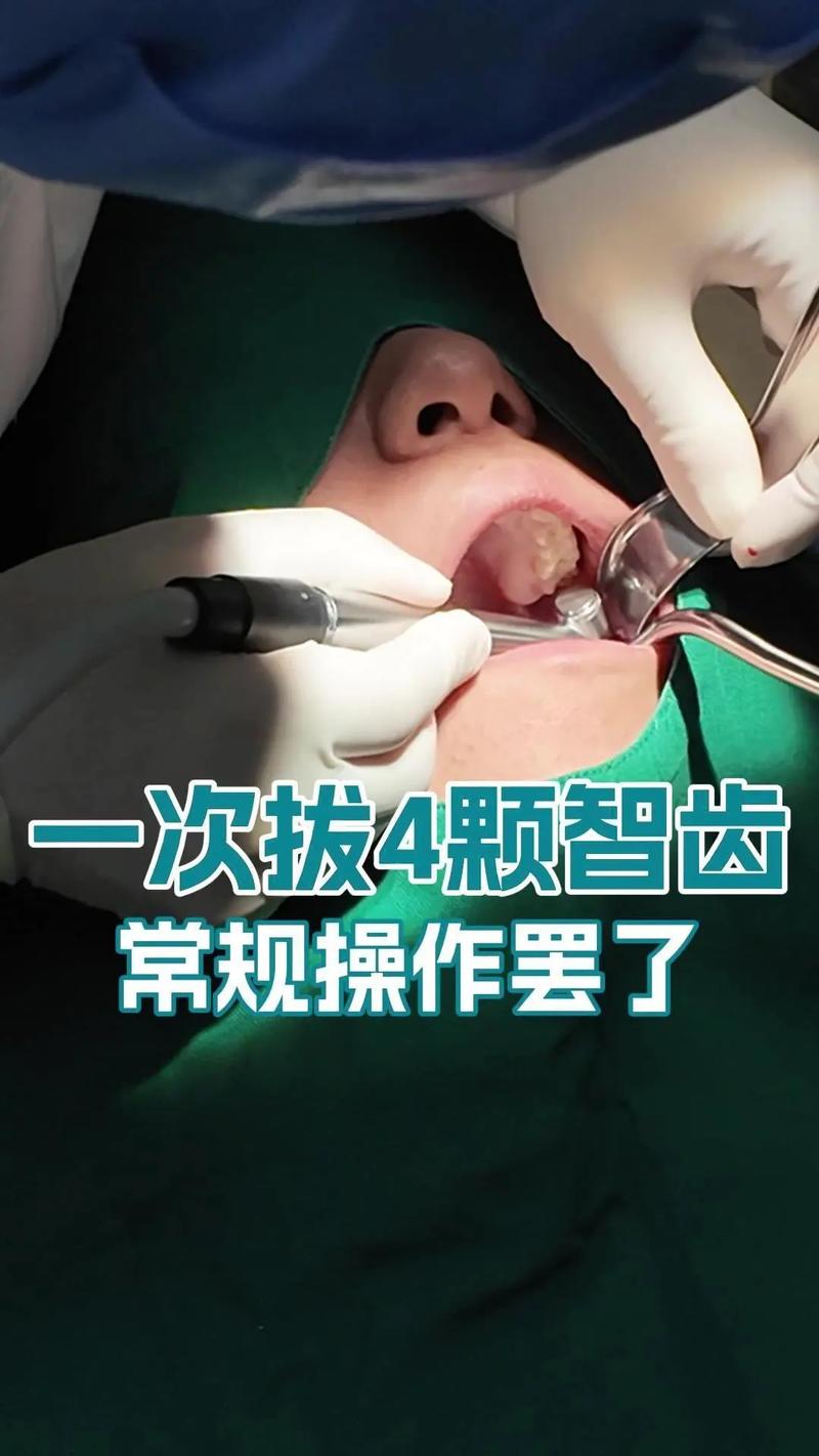 如何掌握简单有效且安全的拔牙操作方法？-图3