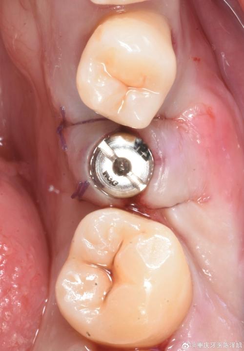 种的牙是什么样子-图3