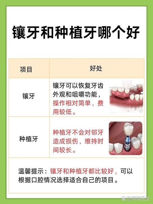 门牙缺损，种牙和镶牙到底选哪个好？-图1