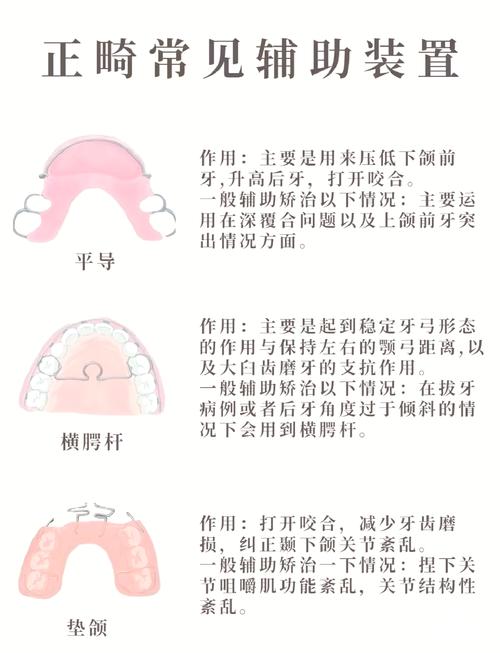 牙齿压低的方法-图3