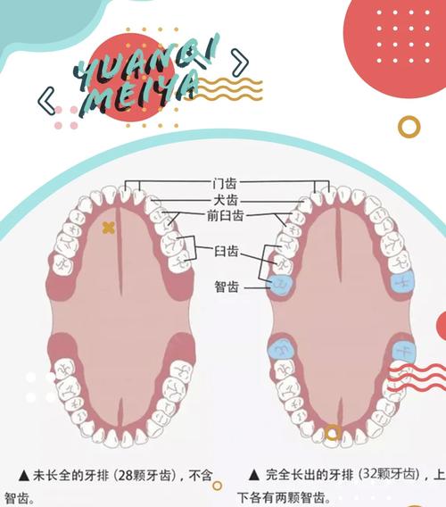 最快的拔牙方法-图3