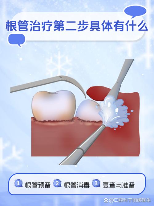 牙髓炎处理方法-图3