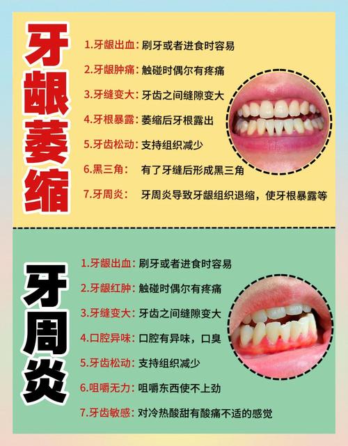 有牙周炎能种牙吗-图2