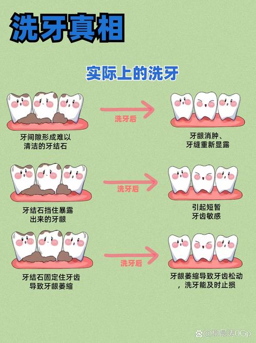 清洁牙齿的方法-图3