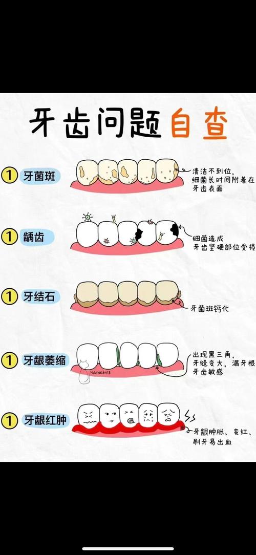 清洁牙齿的方法-图2