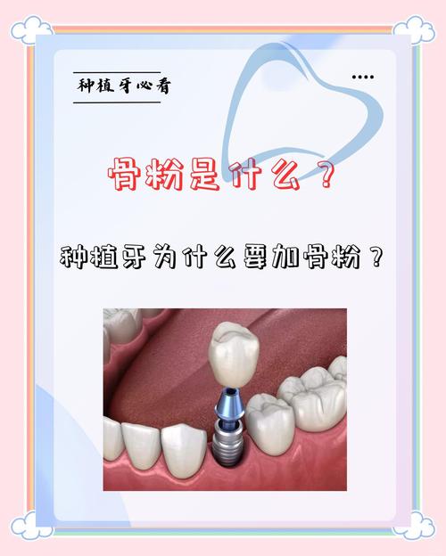 植骨粉种牙副作用有哪些？风险大吗？-图2