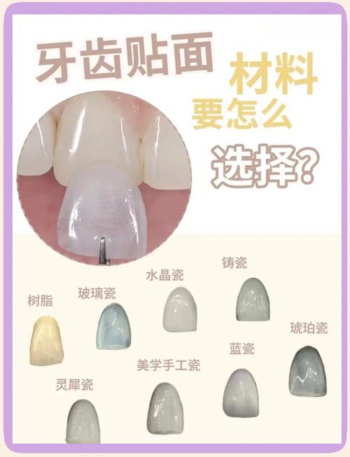 种牙选哪种材料好-图3 种牙选哪种材料好-图3