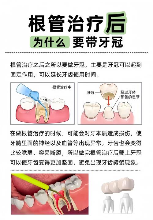 补牙最好方法是什么？如何选择最适合的？-图1