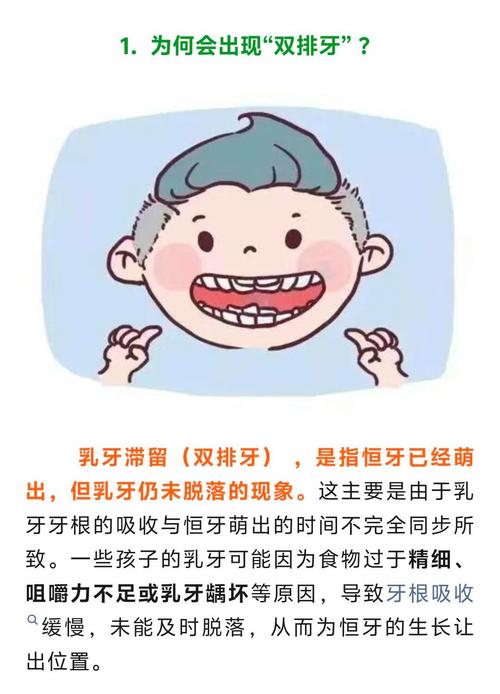 乳牙表示方法有哪些？常用符号是什么？-图3