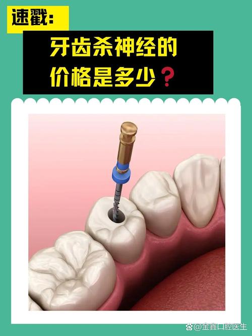 杀牙神经的方法-图2 杀牙神经的方法-图2