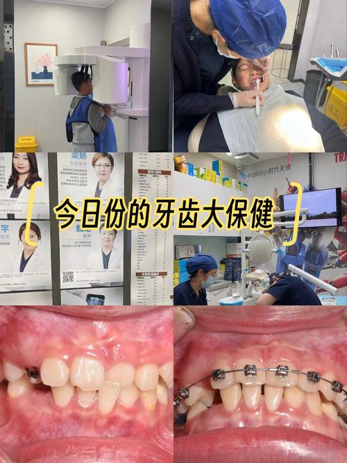 拉萨牙齿正畸哪里做？靠谱机构怎么选？-图2