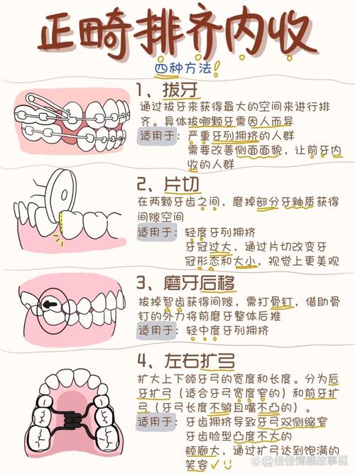 牙齿矫正方法这么多，哪种最适合你？-图2