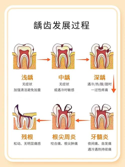 牙齿治疗方法有哪些?如何选择合适方案?-图3 牙齿治疗方法有哪些?如何选择合适方案?-图3