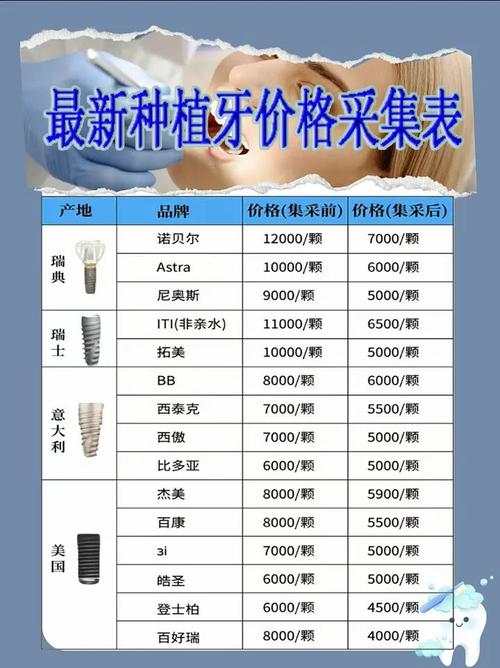 种一颗牙需多少钱-图2 种一颗牙需多少钱-图2