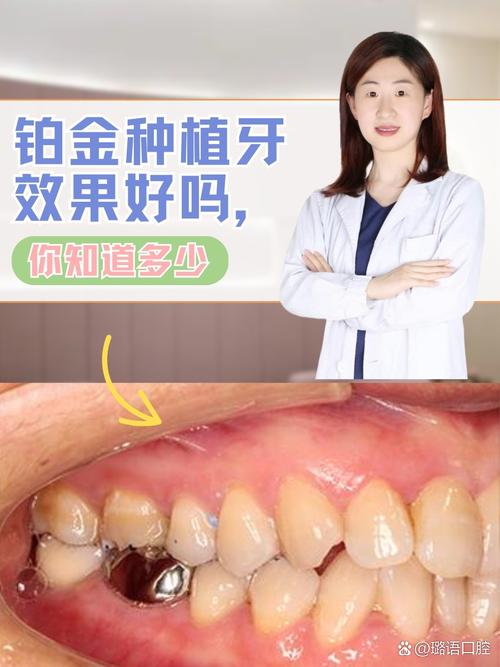 种牙什么材质的好-图2