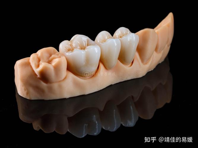 牙齿上釉的方法-图3