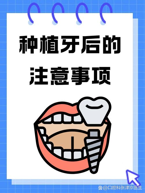 种牙需要注意什么-图3 种牙需要注意什么-图3