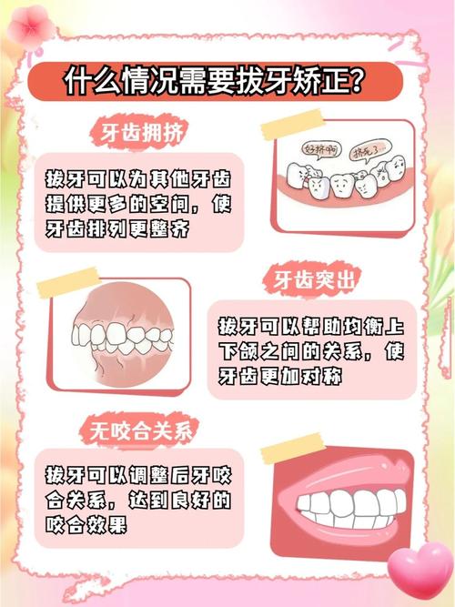 正畸拔牙应考虑的因素-图3 正畸拔牙应考虑的因素-图3