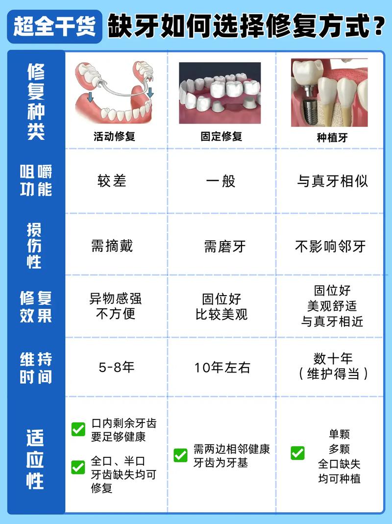 牙齿修复方法有哪些？如何选择适合自己的？-图3