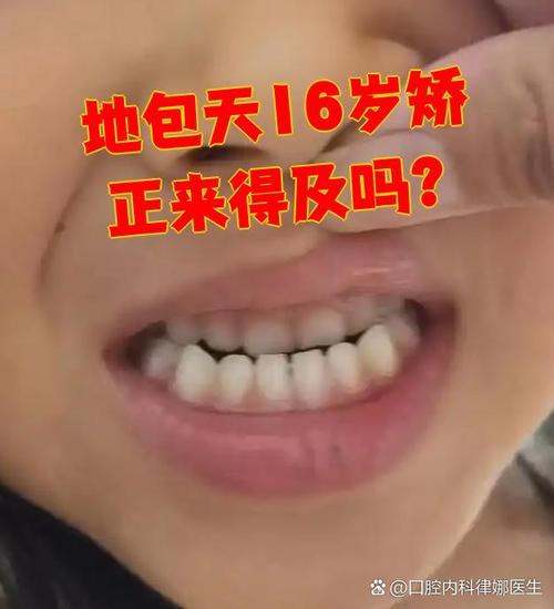 正畸后牙齿咬合有问题-图3