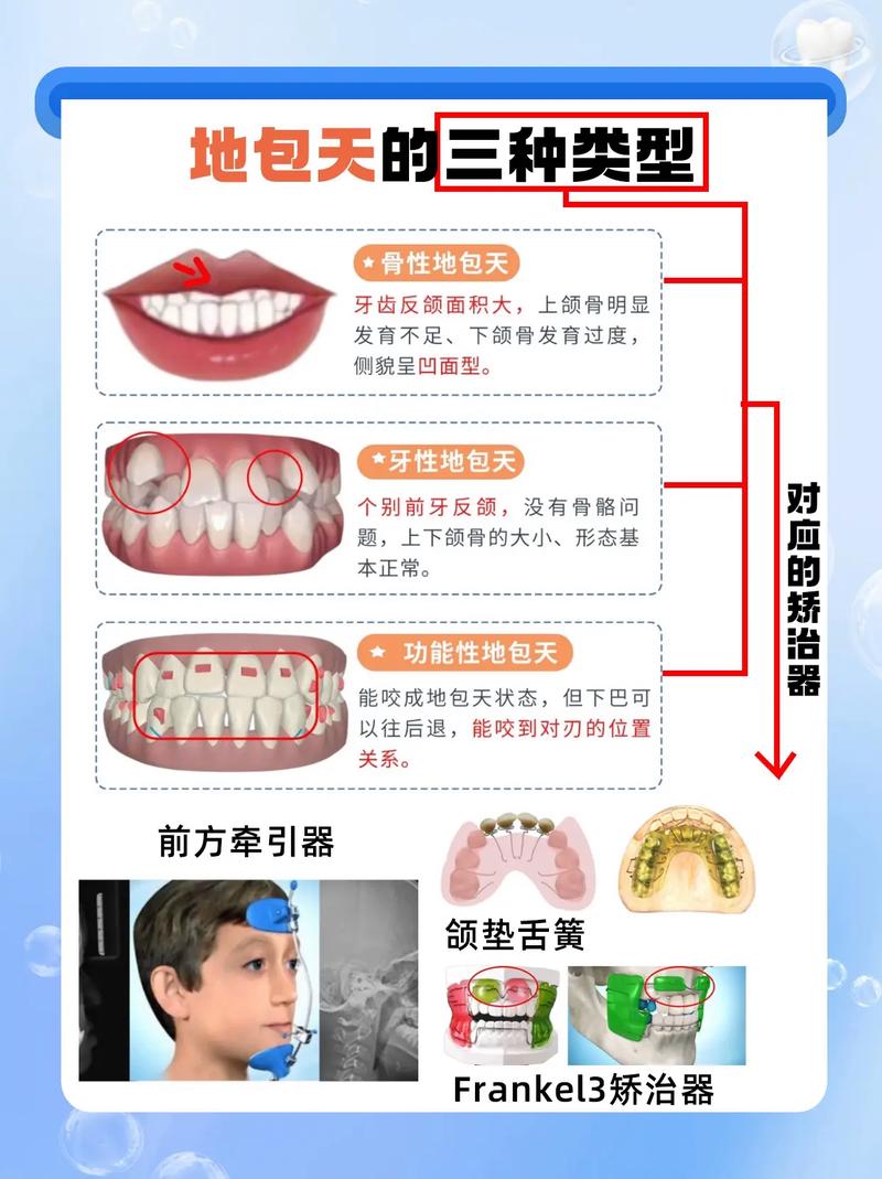 骨性地包天能否通过正畸治疗有效矫正?-图2 骨性地包天能否通过正畸治疗有效矫正?-图2