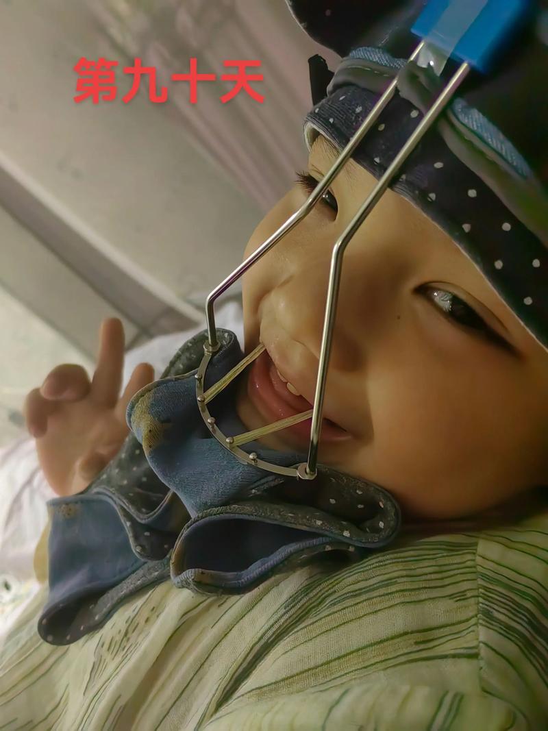 正畸首次复诊没换钢丝，是正常的吗？-图3