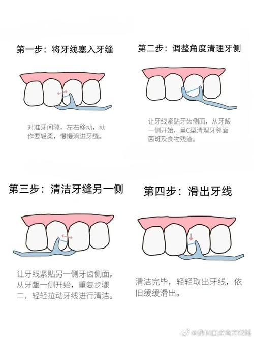 牙线的使用方法-图1