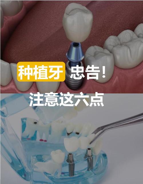 少一颗牙能种吗-图1