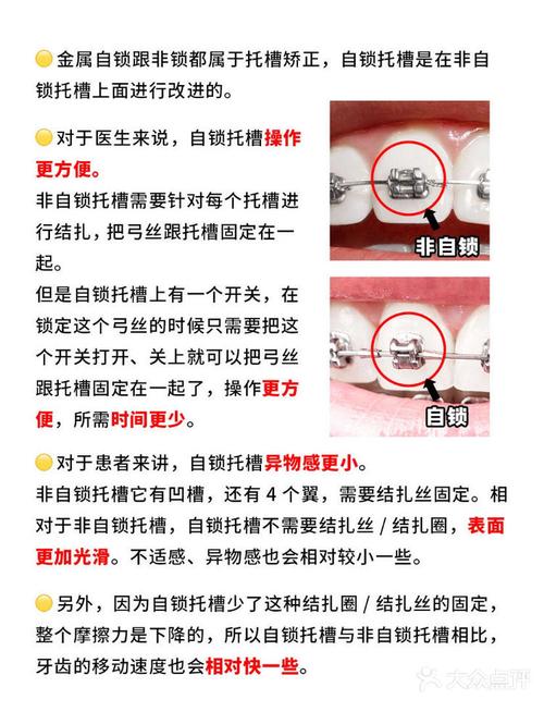 自锁矫正是什么？效果与传统矫正有何不同？-图3
